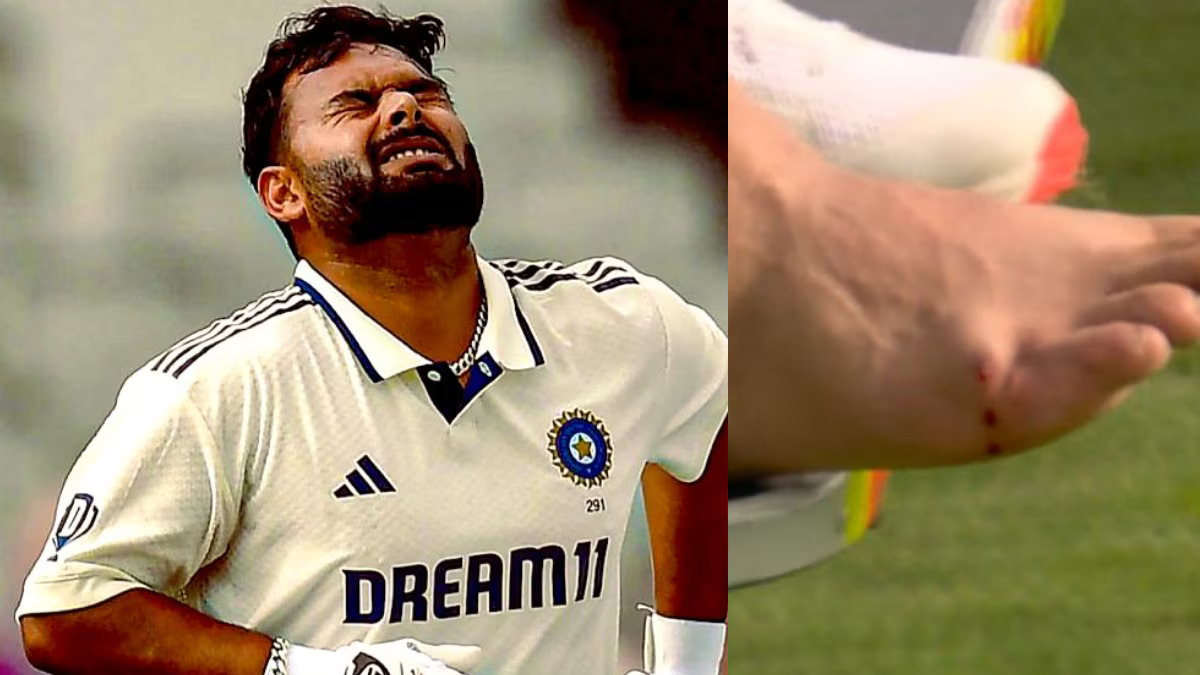 ऋषभ पंत ने पैर की उंगली में फ्रैक्चर की स्थिति पर अपडेट दिया - 'मैं अपना पुनर्वास शुरू करूंगा'